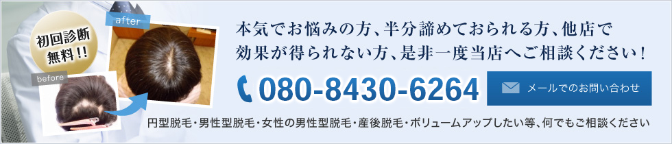 本気でお悩みの方、半分諦めておられる方、他店で効果が得られない方、是非一度当店へご相談ください！ 円型脱毛・男性型脱毛・女性の男性型脱毛・産後脱毛・ボリュームアップしたい等、何でもご相談ください メールでのお問い合わせはこちら